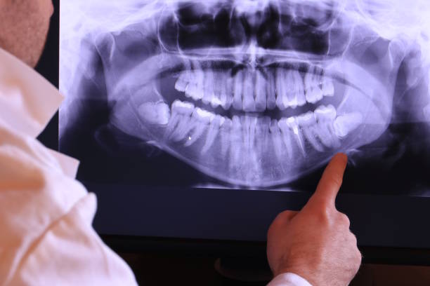 Best Tooth Infection Emergency Dentist  in Evanston, IL