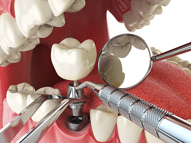 Best Tooth Infection Emergency Dentist  in Evanston, IL